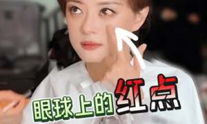 孙俪回应左眼受伤称“被球撞了”！展示伤处眼球上有红点